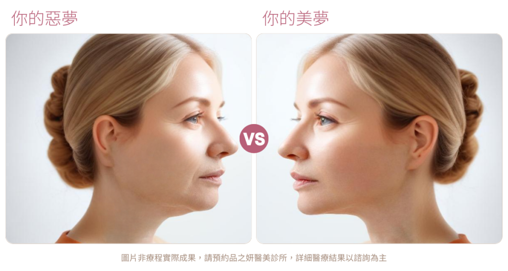 鳳凰電波效果-台北品之妍診所