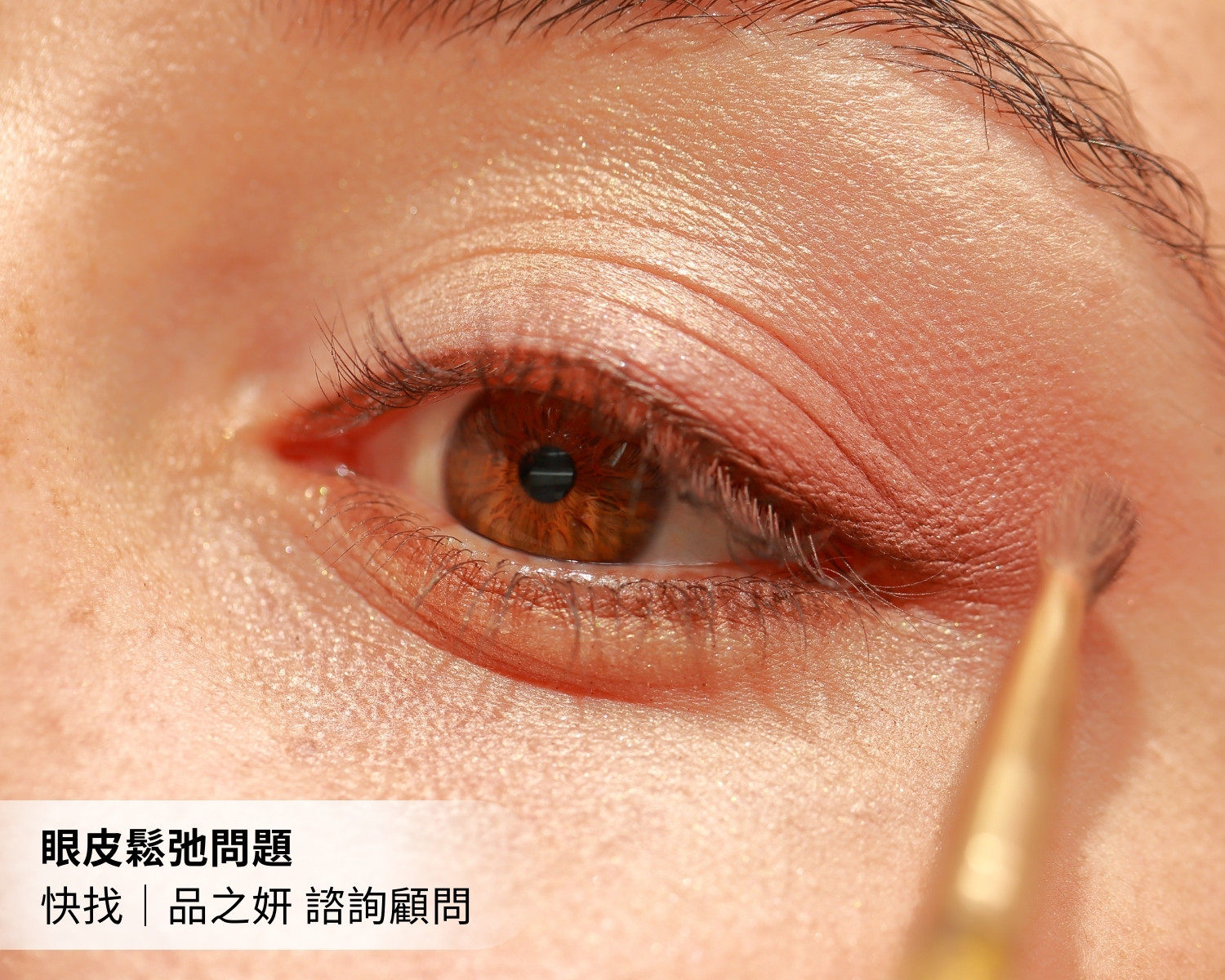 海芙音波解決毛孔粗大 (2)