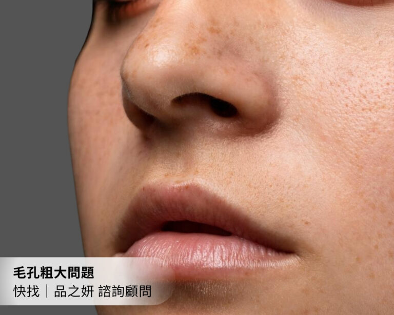 海芙音波解決毛孔粗大問題，毛孔粗大有救嗎