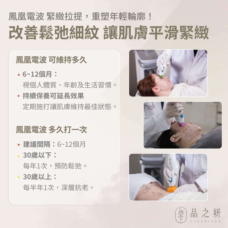 鳳凰電波懶人包-鳳凰電波維持多久、鳳凰電波多久打一次