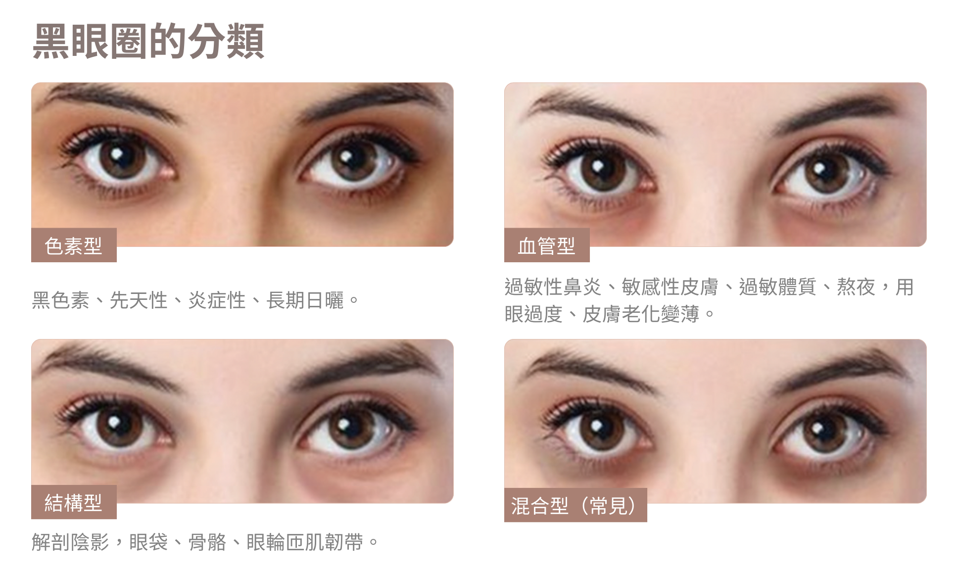黑眼圈的種類